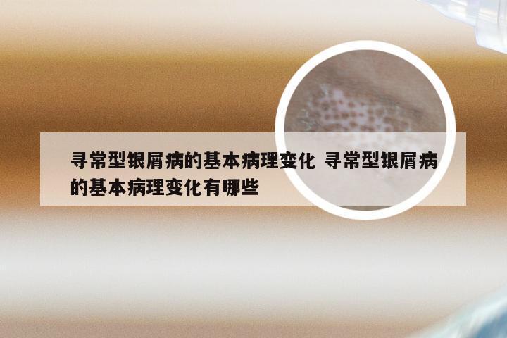 寻常型银屑病的基本病理变化 寻常型银屑病的基本病理变化有哪些