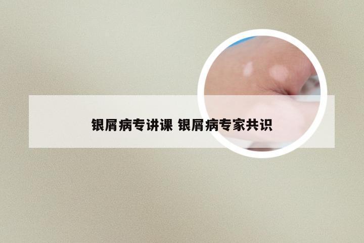 银屑病专讲课 银屑病专家共识