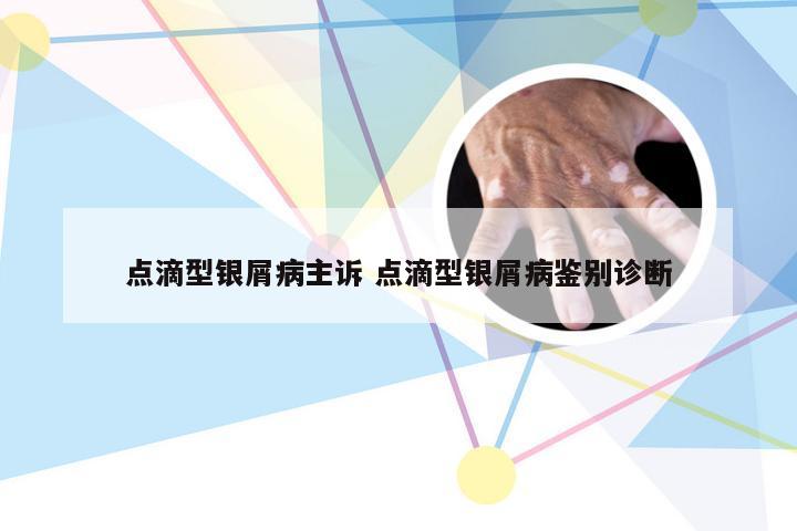 点滴型银屑病主诉 点滴型银屑病鉴别诊断