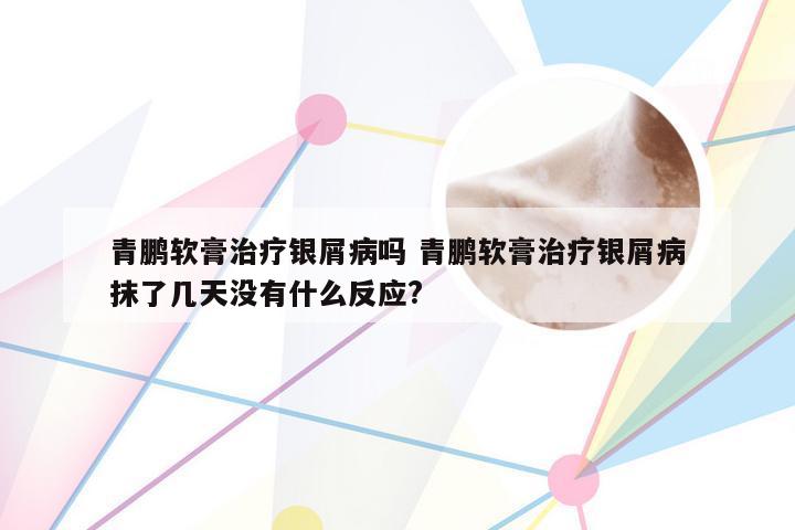 青鹏软膏治疗银屑病吗 青鹏软膏治疗银屑病抹了几天没有什么反应?