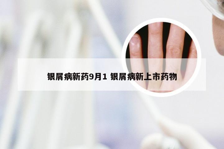 银屑病新药9月1 银屑病新上市药物