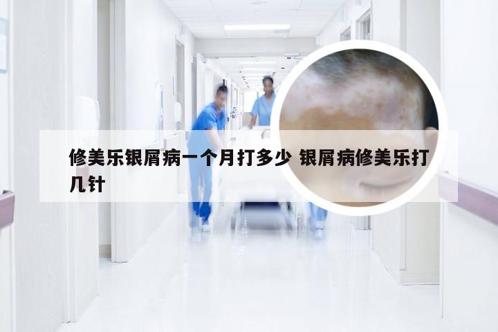修美乐银屑病一个月打多少 银屑病修美乐打几针