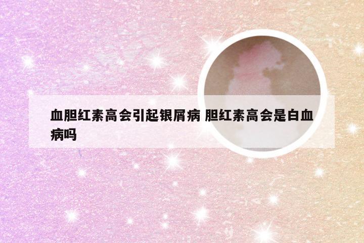 血胆红素高会引起银屑病 胆红素高会是白血病吗