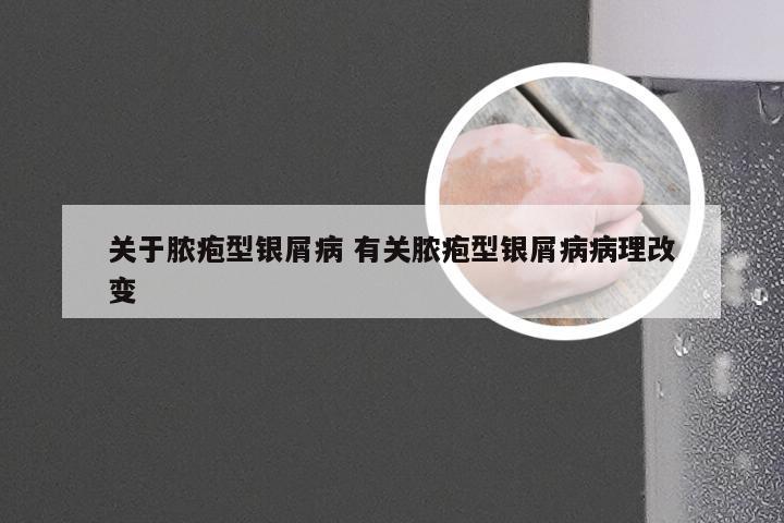 关于脓疱型银屑病 有关脓疱型银屑病病理改变