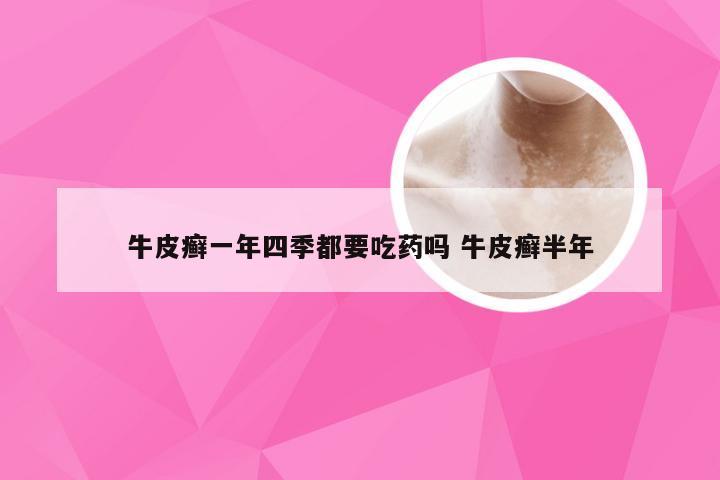 牛皮癣一年四季都要吃药吗 牛皮癣半年