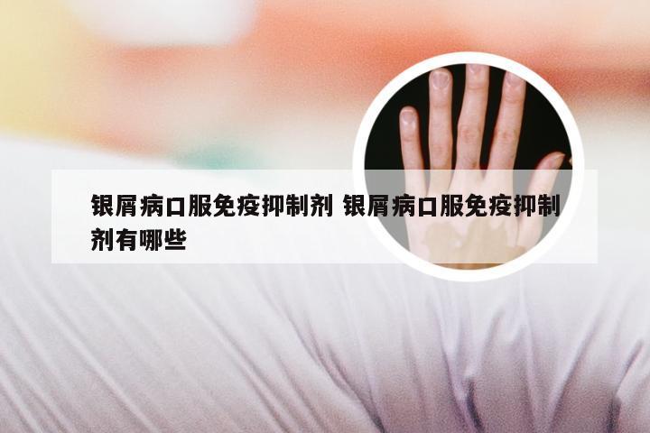 银屑病口服免疫抑制剂 银屑病口服免疫抑制剂有哪些