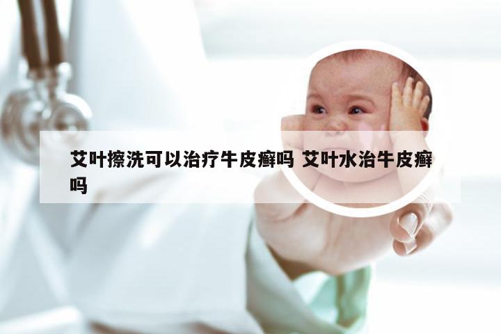 艾叶擦洗可以治疗牛皮癣吗 艾叶水治牛皮癣吗