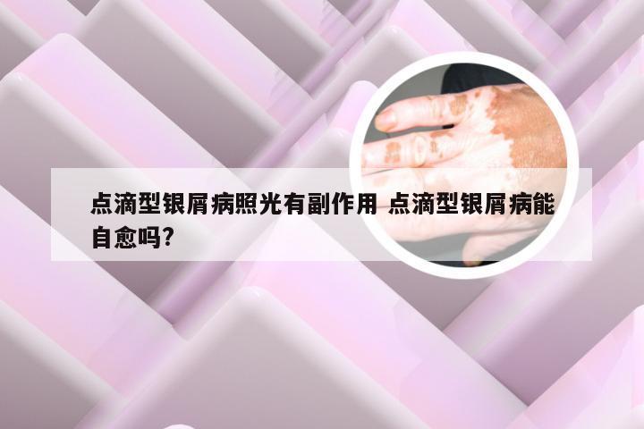 点滴型银屑病照光有副作用 点滴型银屑病能自愈吗?