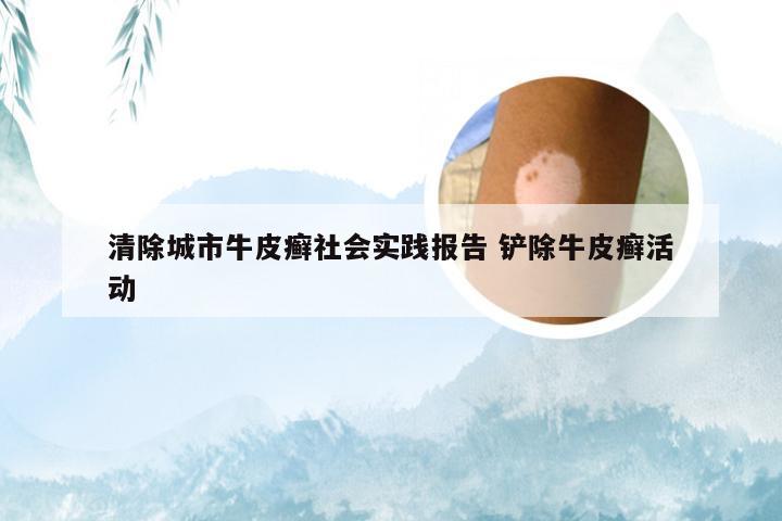 清除城市牛皮癣社会实践报告 铲除牛皮癣活动