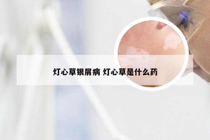 灯心草银屑病 灯心草是什么药