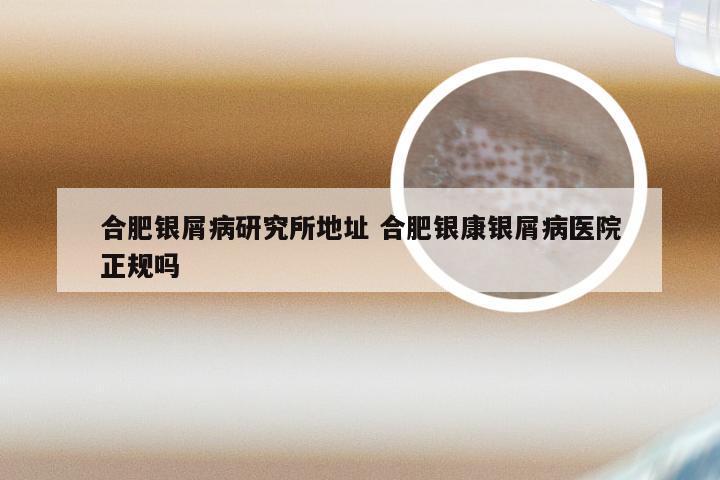 合肥银屑病研究所地址 合肥银康银屑病医院正规吗