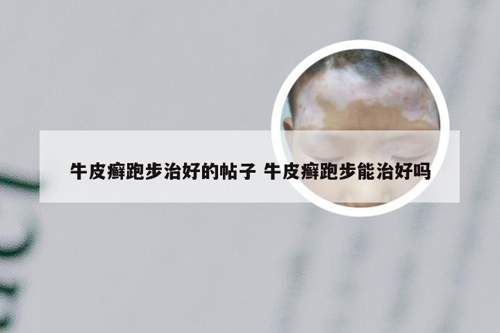 牛皮癣跑步治好的帖子 牛皮癣跑步能治好吗