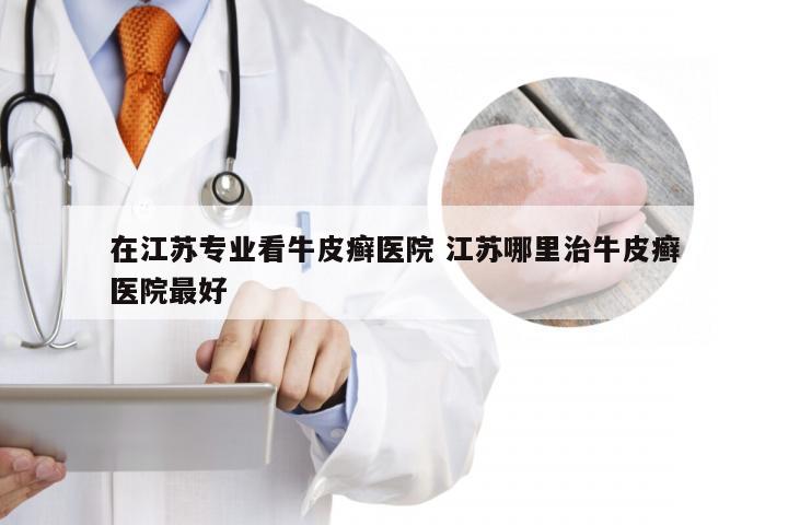 在江苏专业看牛皮癣医院 江苏哪里治牛皮癣医院最好