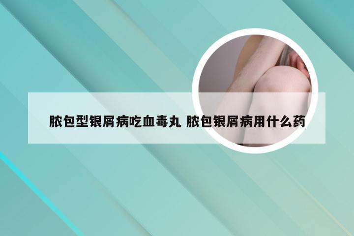 脓包型银屑病吃血毒丸 脓包银屑病用什么药