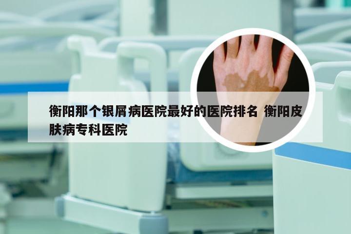衡阳那个银屑病医院最好的医院排名 衡阳皮肤病专科医院