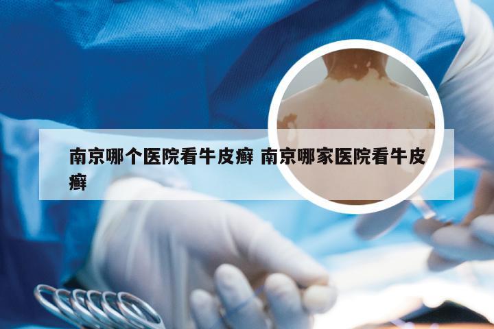 南京哪个医院看牛皮癣 南京哪家医院看牛皮癣