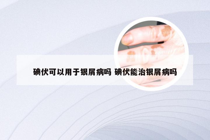 碘伏可以用于银屑病吗 碘伏能治银屑病吗