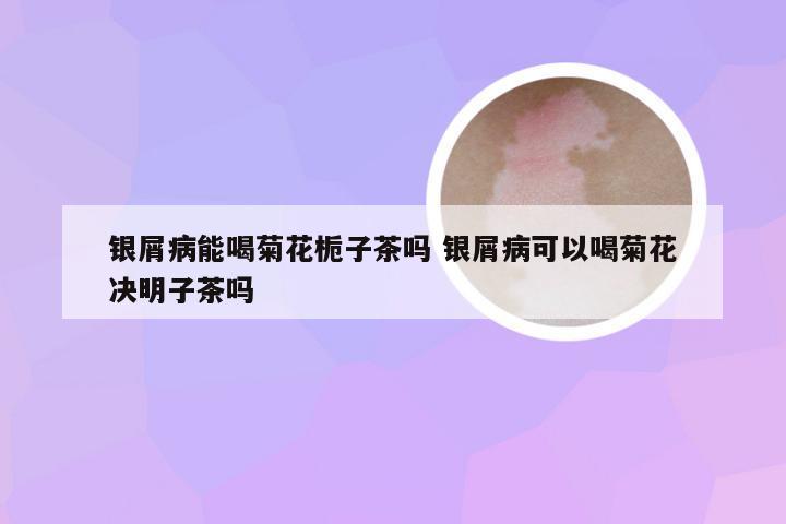 银屑病能喝菊花栀子茶吗 银屑病可以喝菊花决明子茶吗