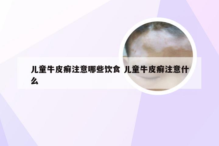 儿童牛皮癣注意哪些饮食 儿童牛皮癣注意什么