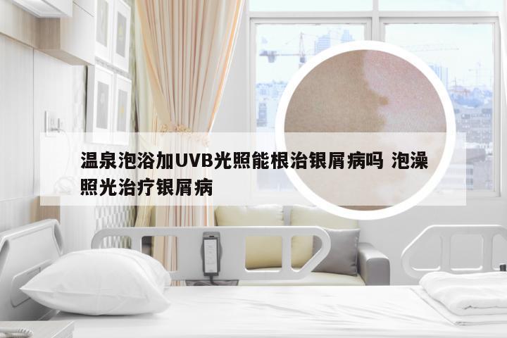温泉泡浴加UVB光照能根治银屑病吗 泡澡照光治疗银屑病