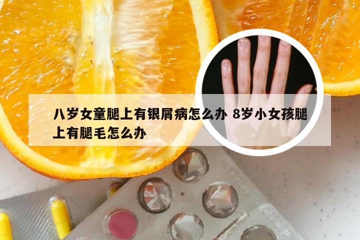 八岁女童腿上有银屑病怎么办 8岁小女孩腿上有腿毛怎么办