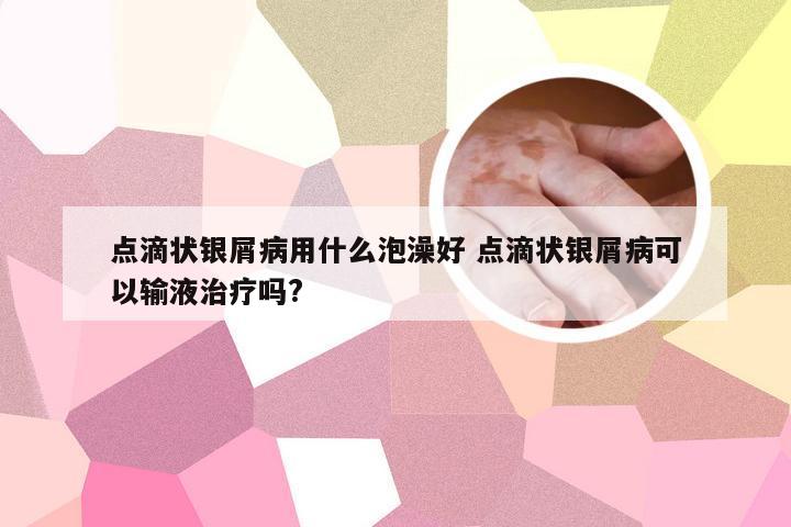 点滴状银屑病用什么泡澡好 点滴状银屑病可以输液治疗吗?