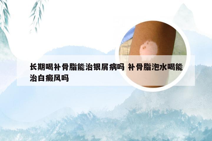 长期喝补骨脂能治银屑病吗 补骨脂泡水喝能治白癜风吗