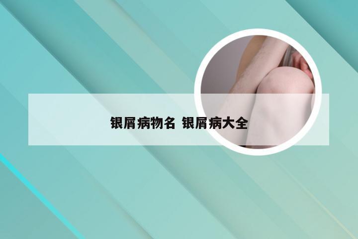 银屑病物名 银屑病大全