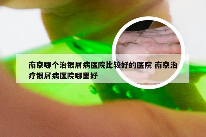 南京哪个治银屑病医院比较好的医院 南京治疗银屑病医院哪里好