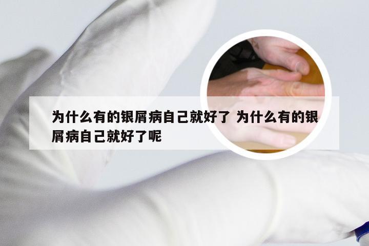 为什么有的银屑病自己就好了 为什么有的银屑病自己就好了呢