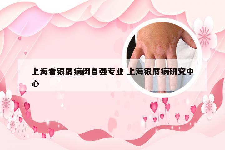 上海看银屑病闵自强专业 上海银屑病研究中心