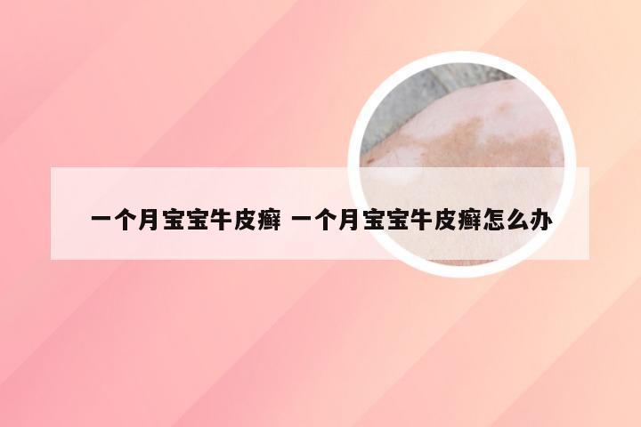 一个月宝宝牛皮癣 一个月宝宝牛皮癣怎么办