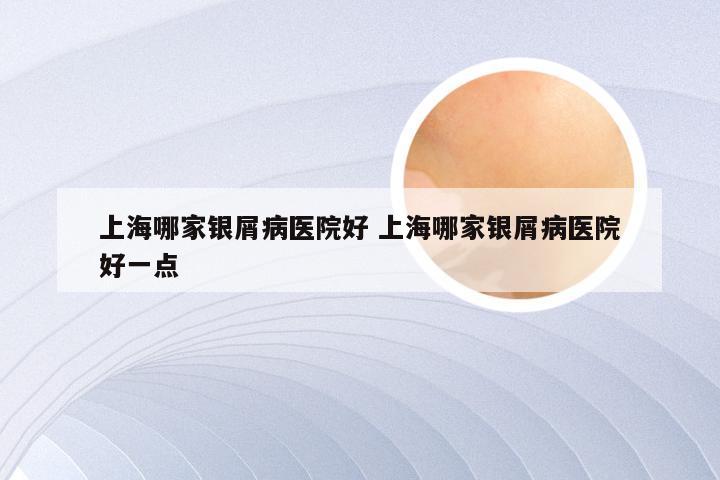 上海哪家银屑病医院好 上海哪家银屑病医院好一点