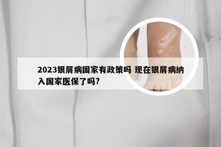 2023银屑病国家有政策吗 现在银屑病纳入国家医保了吗?