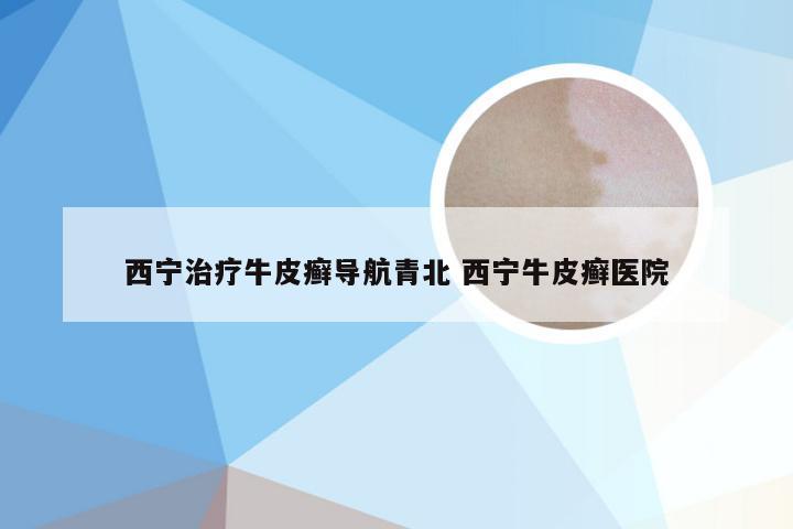 西宁治疗牛皮癣导航青北 西宁牛皮癣医院