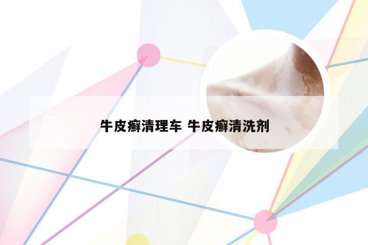牛皮癣清理车 牛皮癣清洗剂