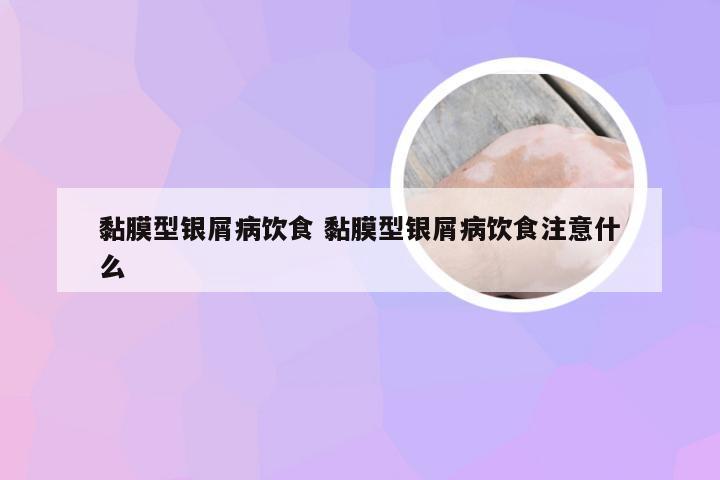 黏膜型银屑病饮食 黏膜型银屑病饮食注意什么