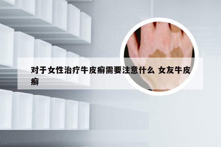 对于女性治疗牛皮癣需要注意什么 女友牛皮癣