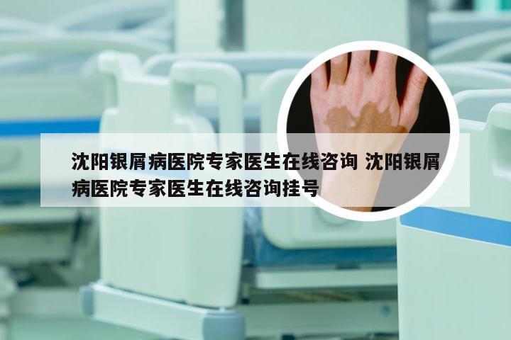沈阳银屑病医院专家医生在线咨询 沈阳银屑病医院专家医生在线咨询挂号