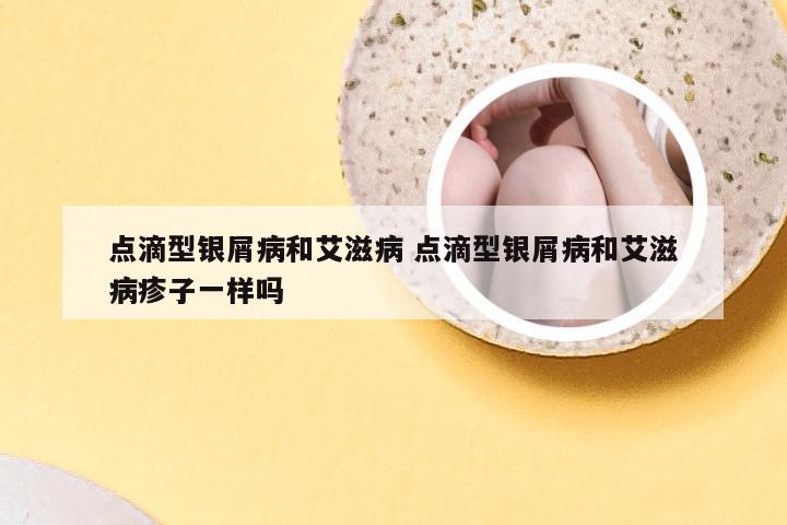 点滴型银屑病和艾滋病 点滴型银屑病和艾滋病疹子一样吗