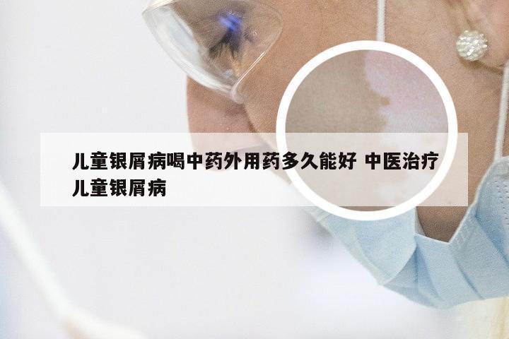 儿童银屑病喝中药外用药多久能好 中医治疗儿童银屑病