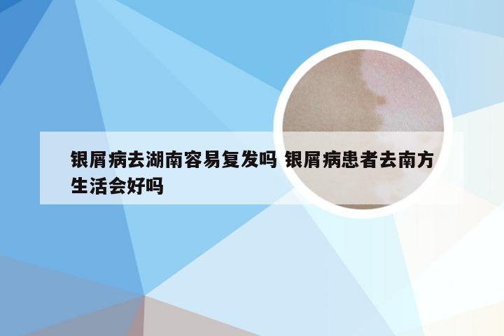 银屑病去湖南容易复发吗 银屑病患者去南方生活会好吗