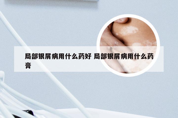 局部银屑病用什么药好 局部银屑病用什么药膏