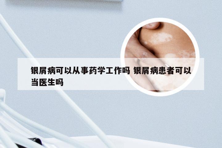 银屑病可以从事药学工作吗 银屑病患者可以当医生吗