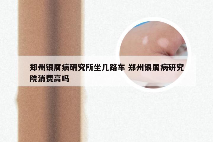 郑州银屑病研究所坐几路车 郑州银屑病研究院消费高吗