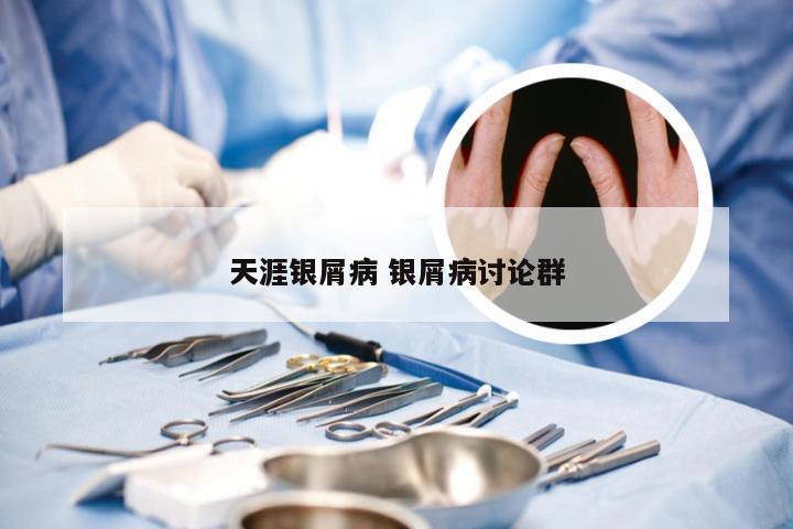 天涯银屑病 银屑病讨论群