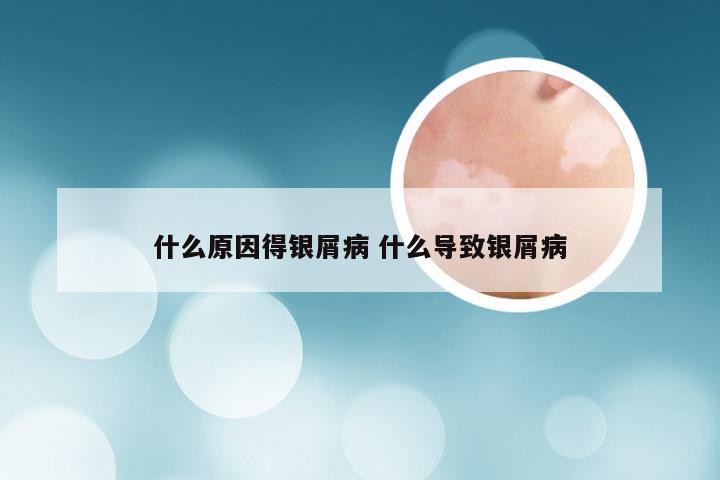 什么原因得银屑病 什么导致银屑病