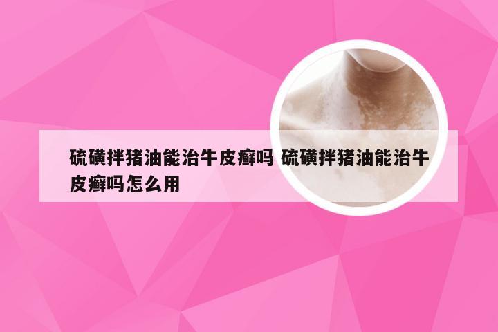 硫磺拌猪油能治牛皮癣吗 硫磺拌猪油能治牛皮癣吗怎么用