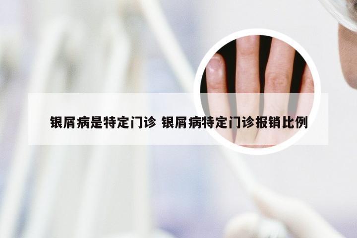 银屑病是特定门诊 银屑病特定门诊报销比例