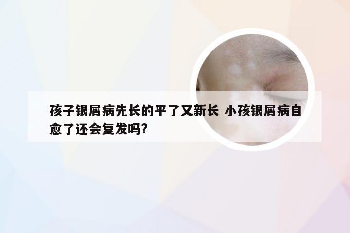 孩子银屑病先长的平了又新长 小孩银屑病自愈了还会复发吗?